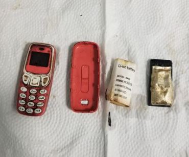 NEVIĐEN SLUČAJ ŠOKIRAO SVE! Hirurg na Kosovu pacijentu iz želuca izvadio NOKIJU 33 10! (FOTO)