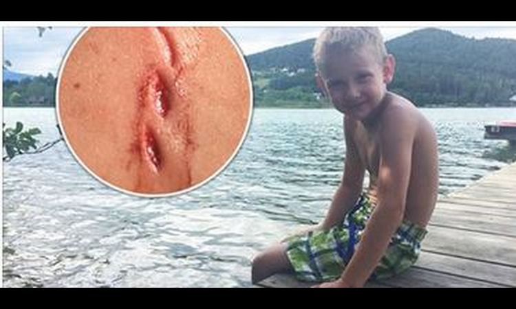 DEČAKA (5) NAPADNUT U JEZERU: Mališana ujela za guzu ogromna štuka!