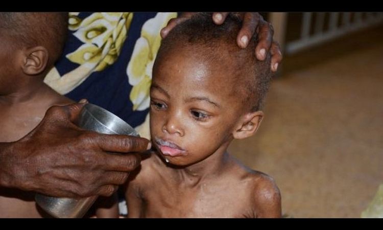 NACIONALNA KATASTROFA U SOMALIJI: Za 48 sati od gladi preminulo 110 ljudi!
