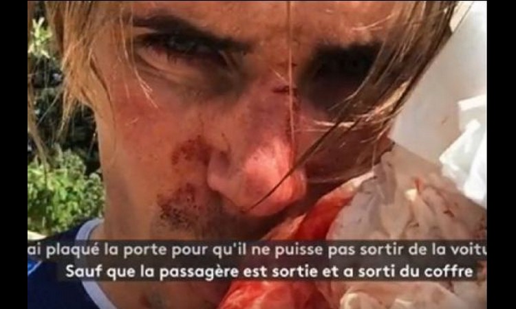 JEZIVE SCENE U PARIZU: Umalo zgazio biciklistu na treningu, a onda ga pretukao bejzbol palicom! (VIDEO)