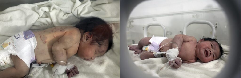 OVO JE BEBA HEROJ KOJA JE ODMAH PO ROĐENJU IZGUBILA CELU PORODICU: Rođena u RUŠEVINAMA, preživela RAZORAN ZEMLJOTRES (FOTO/VIDEO)