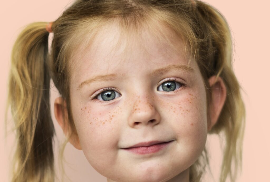 RODITELJI OPREZ: Deca sa atopijskim dermatitisom češće su pozitivna na alergije