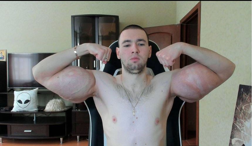 POPAJ SA DEFORMISANIM RUKAMA: Da li postoji ružniji biceps?! (VIDEO)