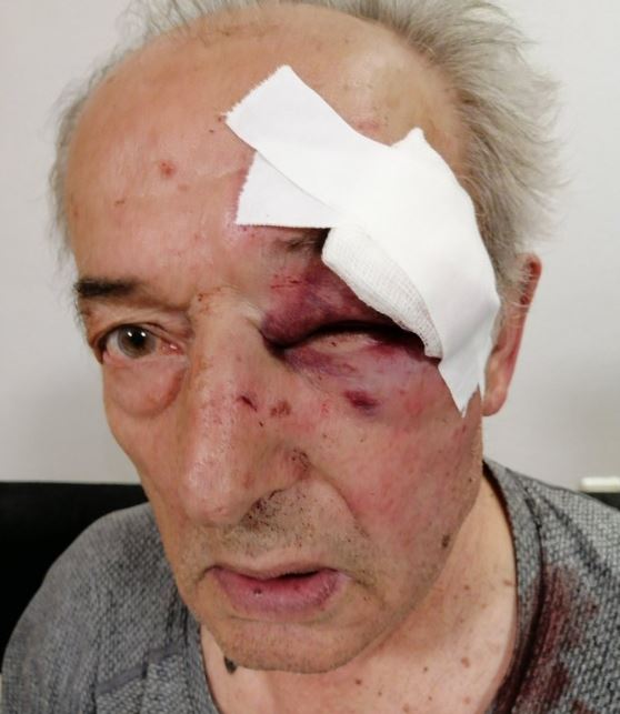 Oglasio se pretučeni general u penziji: „Izašao sam iz bolnice, možda mi je poznat napadač“ (FOTO)