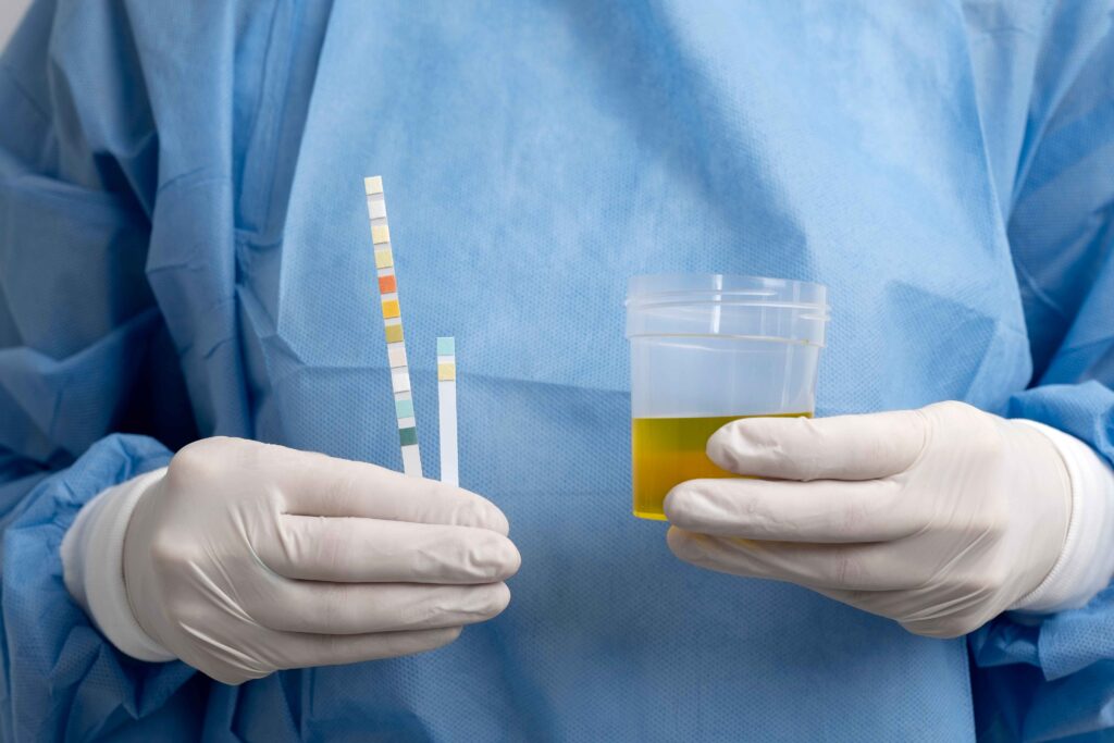 NAMIRNICE KOJE MENJAJU MIRIS URINA: Stručnjak otkriva kada bi trebalo posetiti doktora