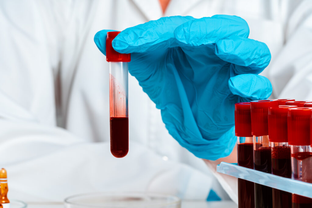 PET METODA KOJE OBEĆAVAJU: Kada će se u medicinskim ustanovama naći veštačka krv?